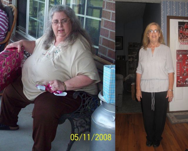 amazing_weight_loss_before_and_after_part_2_640_03