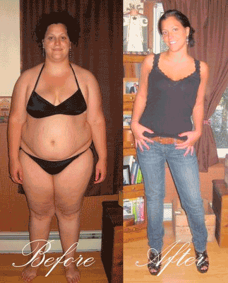 before-and-after-healthy-weight-loss-24777069-323-400