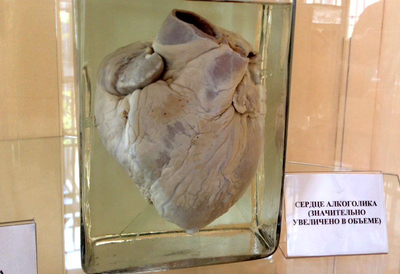 Сердце алкоголика. фото 26