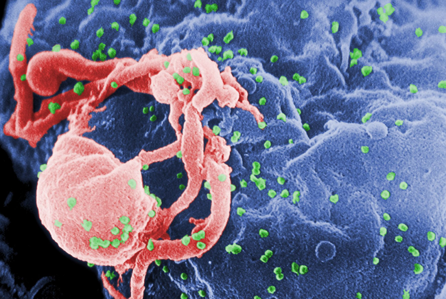 ВИЧ (зеленые точки; розовое — это лимфоцит) на зараженной клетке. Микрофотография: C. Goldsmith Content Providers: CDC/ C. Goldsmith, P. Feorino, E. L. Palmer, W. R. McManus / CDC