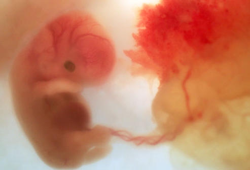 эмбрион зожник